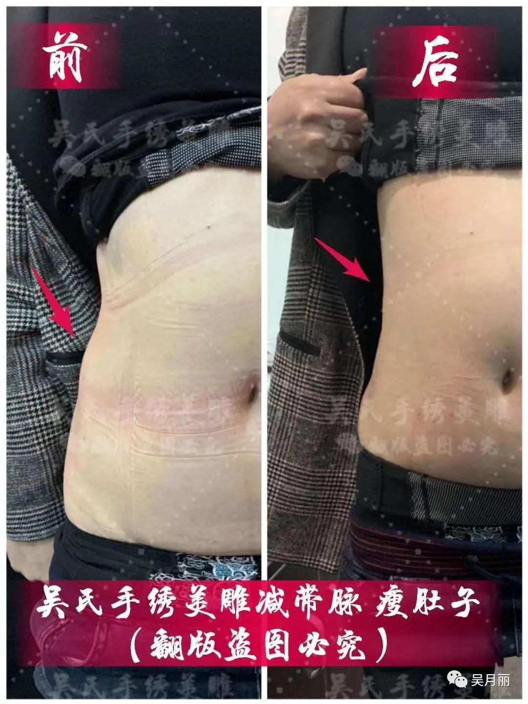 全面复工美丽出行