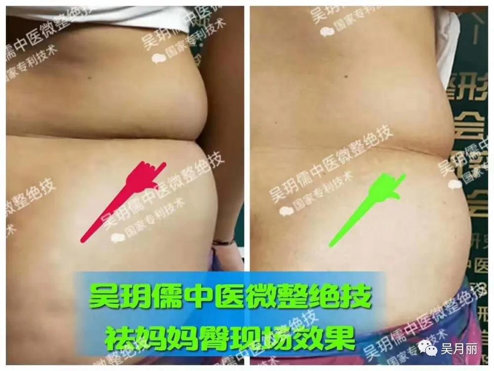 全面复工美丽出行